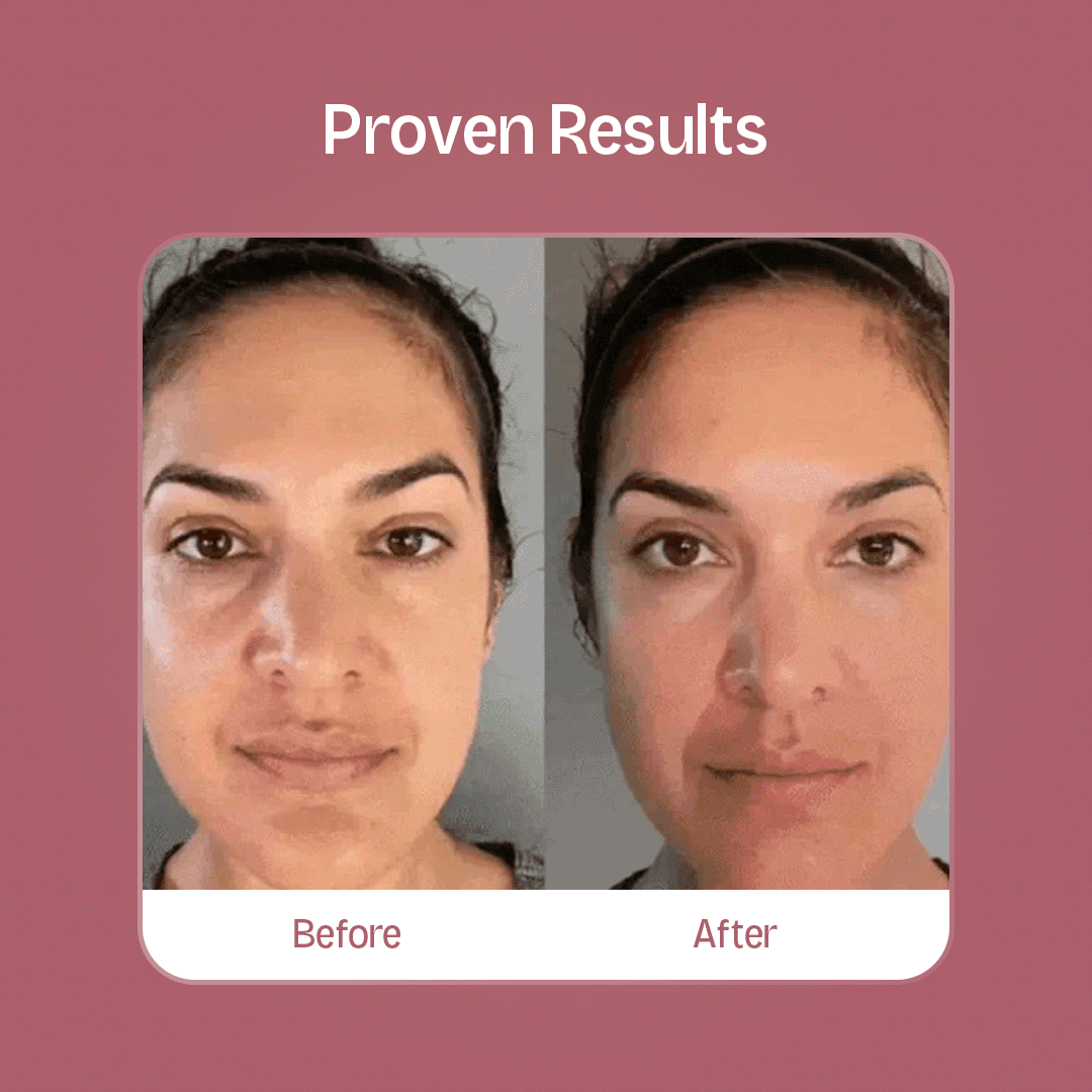 Face & Neck 7-in-1 LED + EMS Sculptor